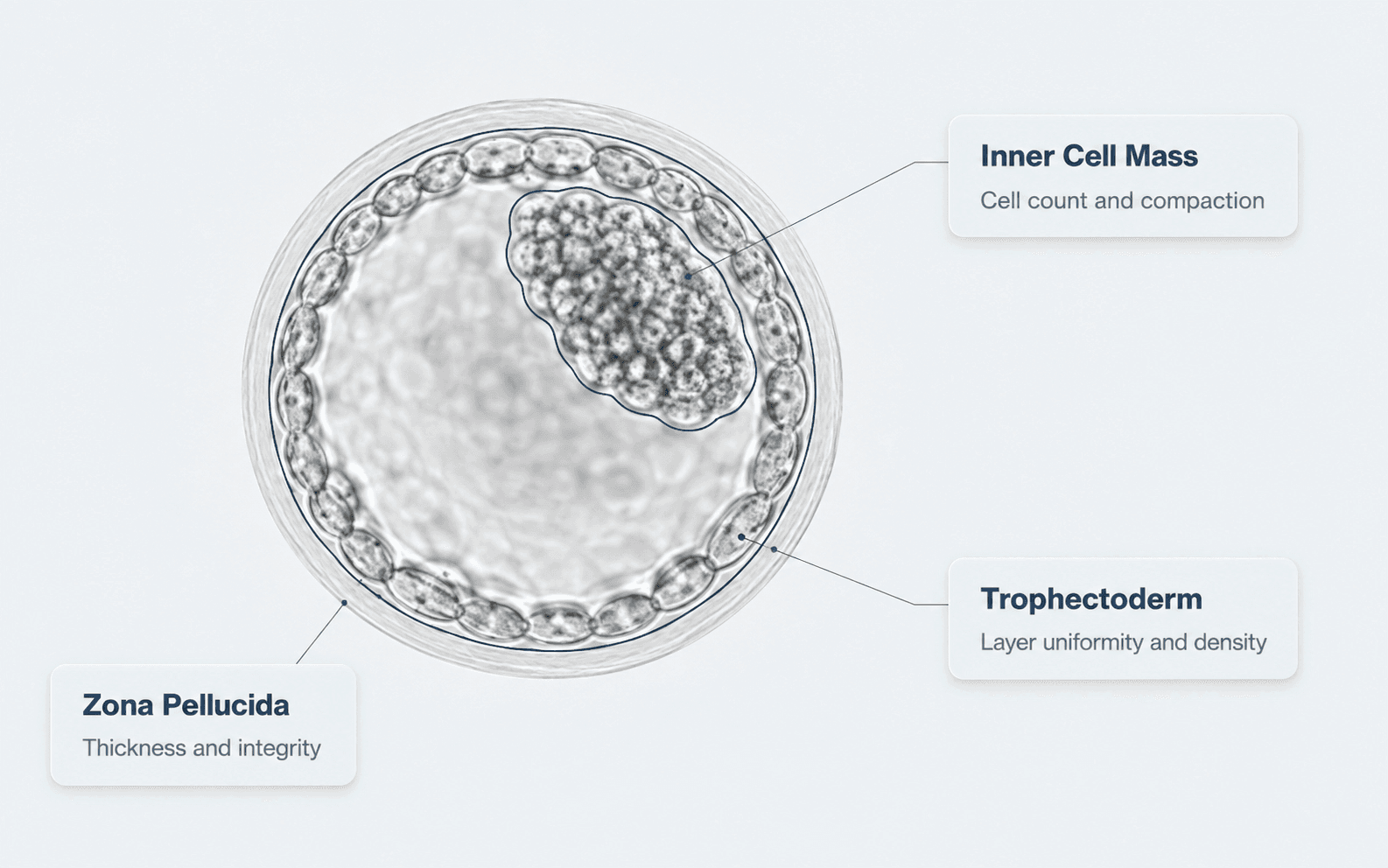 A blastocyst micrograph with its three graded structures called out: Inner Cell Mass — cell count and compaction, Trophectoderm — layer uniformity and density, and Zona Pellucida — thickness and integrity.